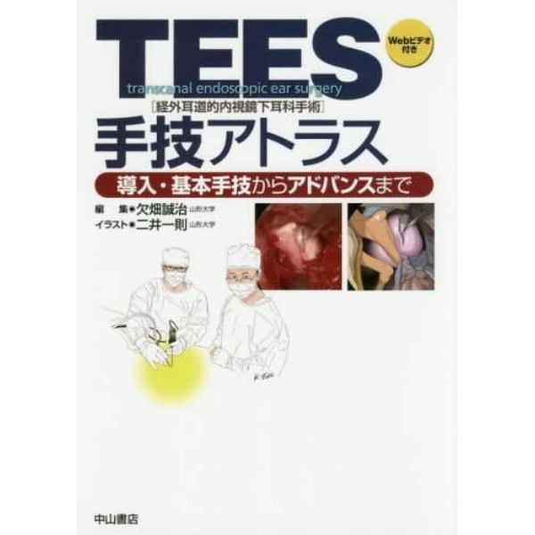 ＴＥＥＳ〈経外耳道的内視鏡下耳科手術〉手技アトラス　導入・基本手技からアドバンスまで