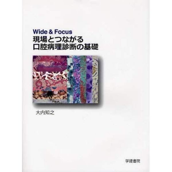 現場とつながる口腔病理診断の基礎　Ｗｉｄｅ　＆　Ｆｏｃｕｓ