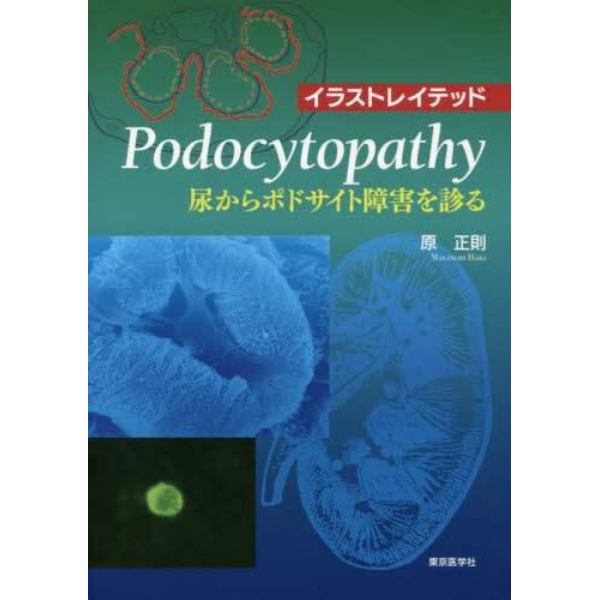 イラストレイテッドＰｏｄｏｃｙｔｏｐａｔｈｙ　尿からポドサイト障害を診る