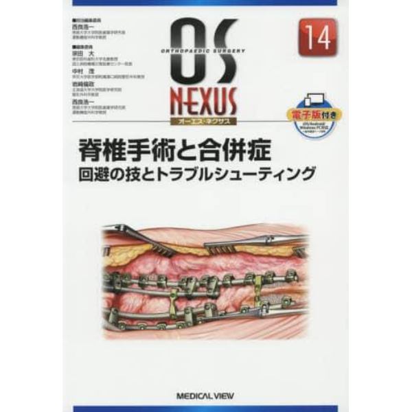 脊椎手術と合併症　回避の技とトラブルシューティング