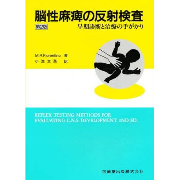 脳性麻痺の反射検査　早期診断と治療の手がかり