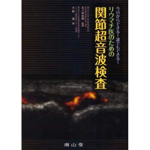 リウマチ医のための関節超音波検査　今日からできる！誰でもできる！