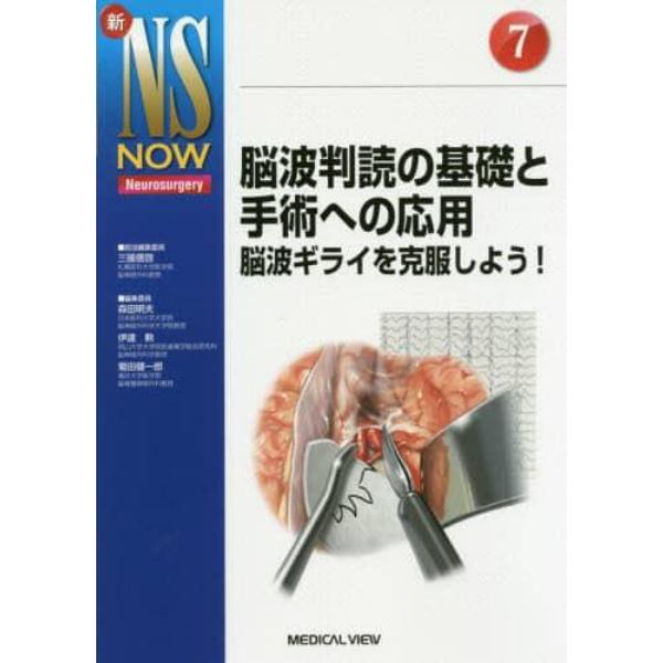 脳波判読の基礎と手術への応用　脳波ギライを克服しよう！