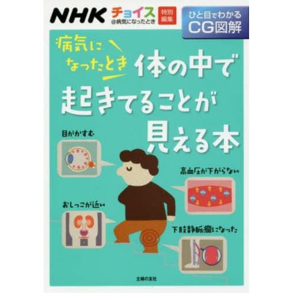 病気になったとき体の中で起きてることが見える本　ひと目でわかるＣＧ図解