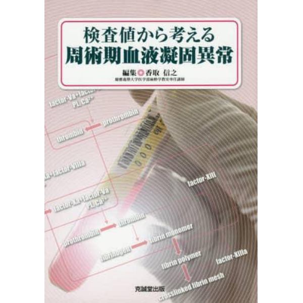 検査値から考える周術期血液凝固異常