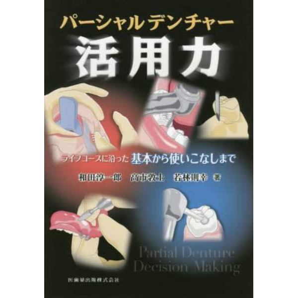 パーシャルデンチャー活用力　ライフコースに沿った基本から使いこなしまで