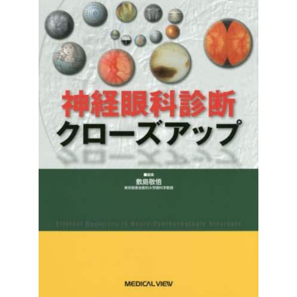 神経眼科診断クローズアップ