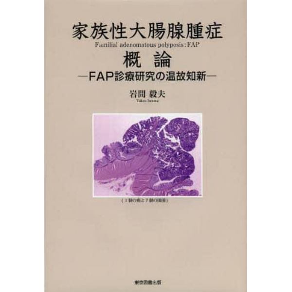 家族性大腸腺腫症概論　ＦＡＰ診療研究の温故知新