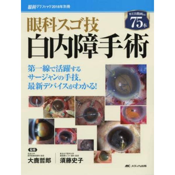 眼科スゴ技白内障手術　第一線で活躍するサージャンの手技，最新デバイスがわかる！