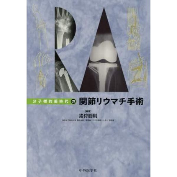 分子標的薬時代の関節リウマチ手術