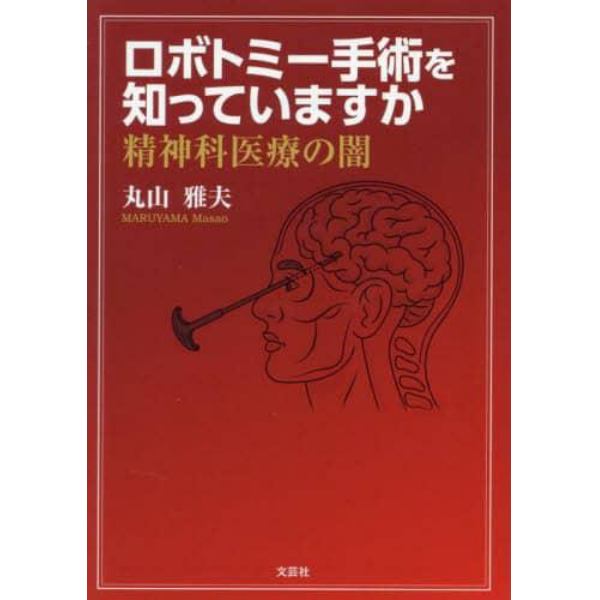 ロボトミー手術を知っていますか