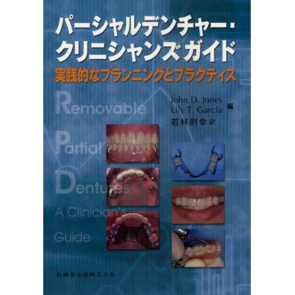 パーシャルデンチャー・クリニシャンズガイド　実践的なプランニングとプラクティス
