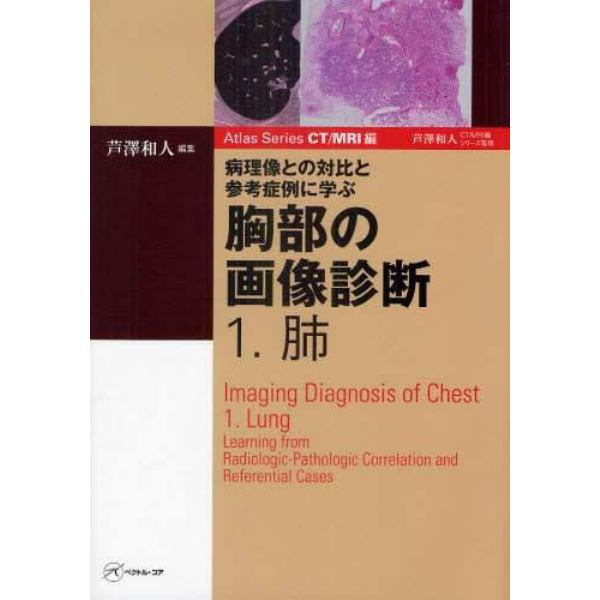 胸部の画像診断　病理像との対比と参考症例に学ぶ　１