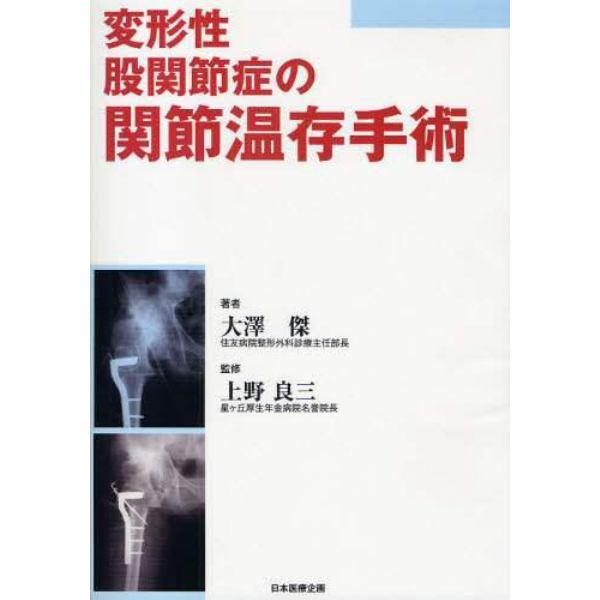 変形性股関節症の関節温存手術