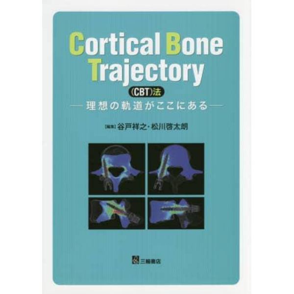 Ｃｏｒｔｉｃａｌ　Ｂｏｎｅ　Ｔｒａｊｅｃｔｏｒｙ〈ＣＢＴ〉法　理想の軌道がここにある