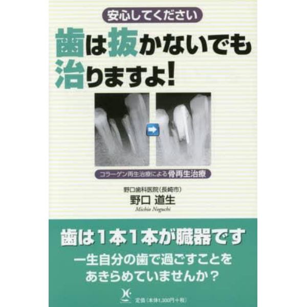 歯は抜かないでも治りますよ！　安心してください　コラーゲン再生治療による骨再生治療