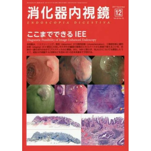 消化器内視鏡　Ｖｏｌ．２９Ｎｏ．１２（２０１７Ｄｅｃｅｍｂｅｒ）