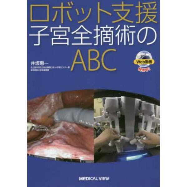 ロボット支援子宮全摘術のＡＢＣ