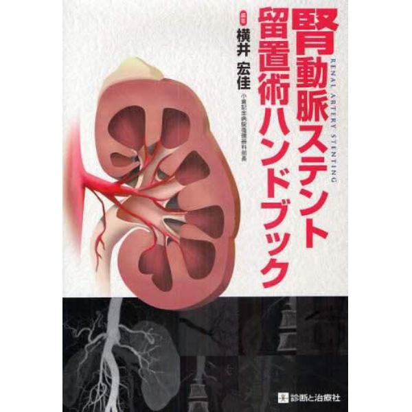 腎動脈ステント留置術ハンドブック