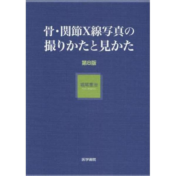 骨・関節Ｘ線写真の撮りかたと見かた