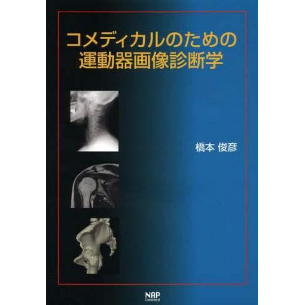 コメディカルのための運動器画像診断学