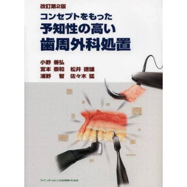 コンセプトをもった予知性の高い歯周外科処置