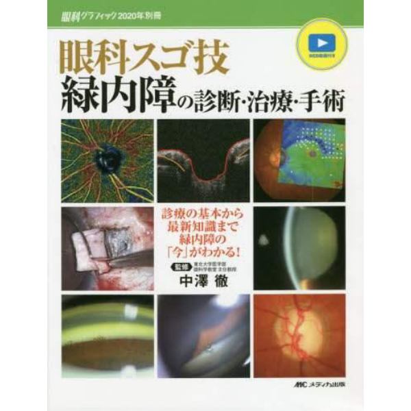 眼科スゴ技緑内障の診断・治療・手術　診療の基本から最新知識まで緑内障の「今」がわかる！　ＷＥＢ動画付き