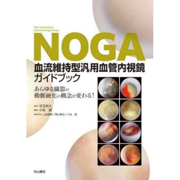 ＮＯＧＡ血流維持型汎用血管内視鏡ガイドブック　あらゆる臓器の動脈硬化の概念が変わる！