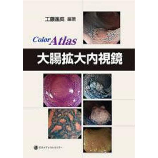 大腸拡大内視鏡　Ｃｏｌｏｒ　Ａｔｌａｓ