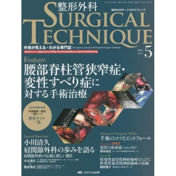 整形外科サージカルテクニック　手術が見える・わかる専門誌　第４巻５号（２０１４－５）