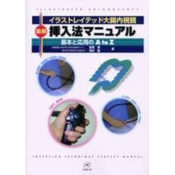 図解挿入法マニュアル　イラストレイテッド大腸内視鏡　基本と応用のＡ　ｔｏ　Ｚ