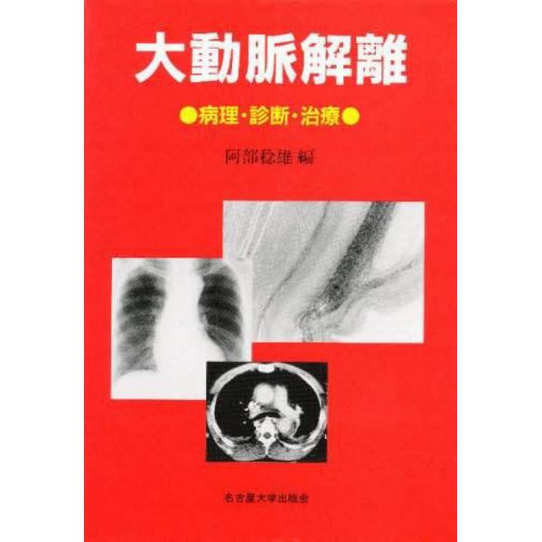 大動脈解離　病理・診断・治療