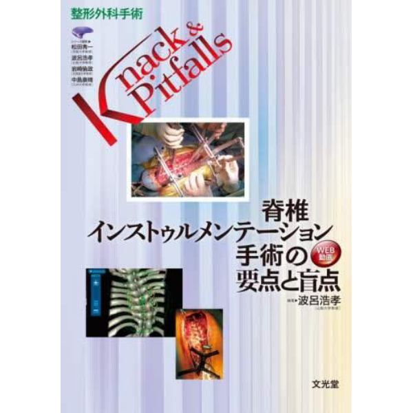 脊椎インストゥルメンテーション手術の要点と盲点