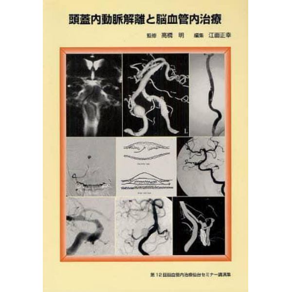 頭蓋内動脈解離と脳血管内治療　第１２回脳血管内治療仙台セミナー講演集