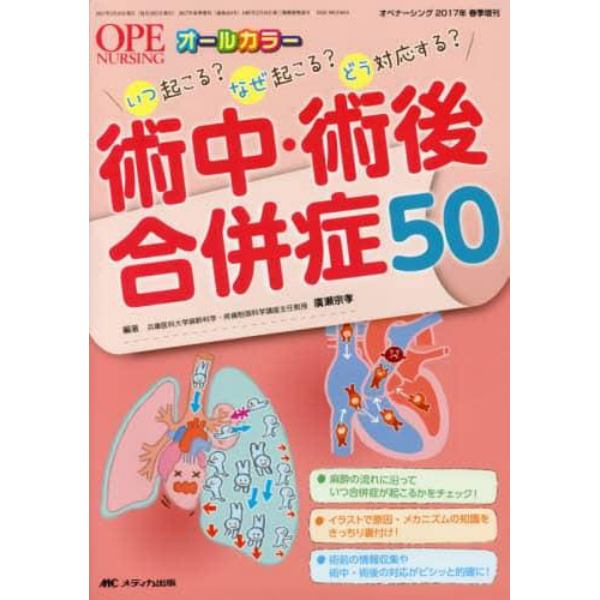 術中・術後合併症５０　いつ起こる？なぜ起こる？どう対応する？　オールカラー