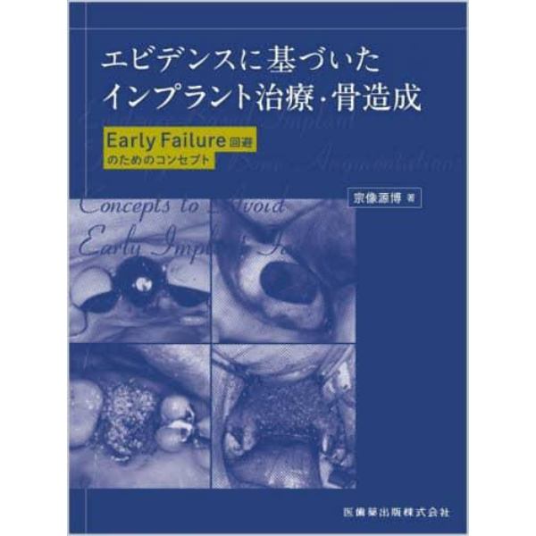 エビデンスに基づいたインプラント治療・骨造成　Ｅａｒｌｙ　Ｆａｉｌｕｒｅ回避のためのコンセプト