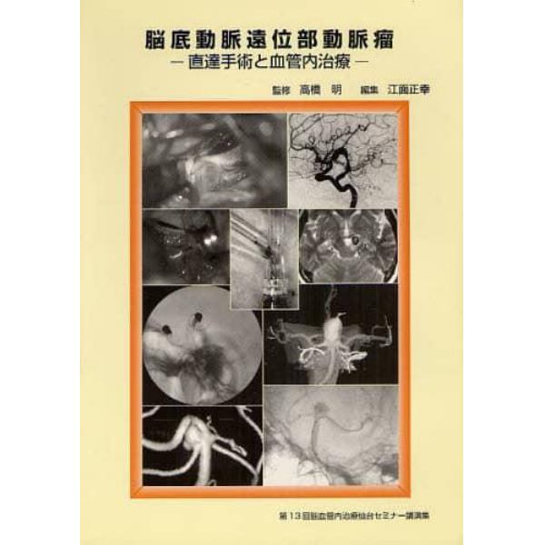脳底動脈遠位部動脈瘤　直達手術と血管内治療　第１３回脳血管内治療仙台セミナー講演集