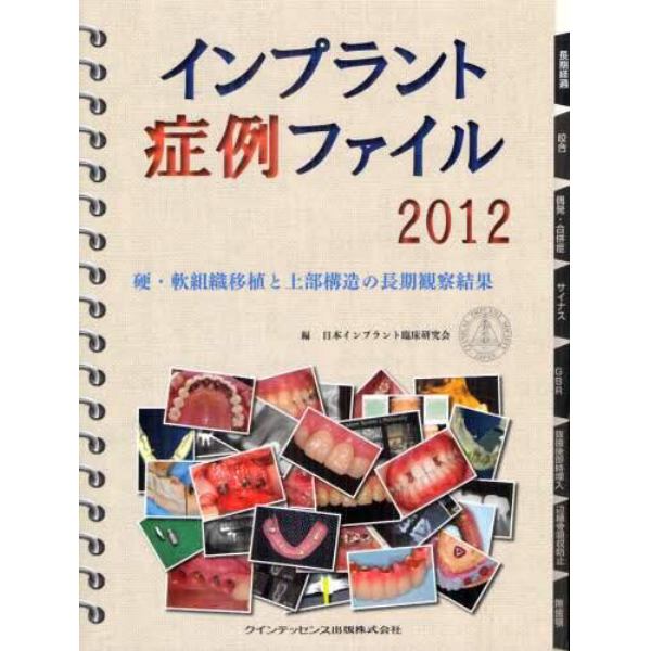 インプラント症例ファイル　２０１２