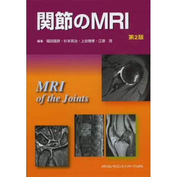 関節のＭＲＩ