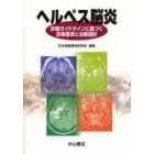 ヘルペス脳炎　診療ガイドラインに基づく診断基準と治療指針