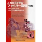 これならできるファイバー挿管　エアウェイスコープ，トラキライト実践ガイド付き