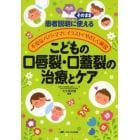 こどもの口唇裂・口蓋裂の治療とケア　患者説明にそのまま使える　不安なパパ・ママにイラストでやさしく解説