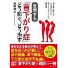 急増する「首下がり症」どう防ぐ、どう治す　首が重く感じる、上を向きづらい、歩くとふらつく人は要注意