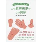 ジェネラリスト必携！この皮膚疾患のこの発疹