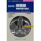 わかる！頭頚部画像診断の要点