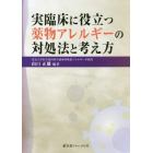 実臨床に役立つ薬物アレルギーの対処法と考え方