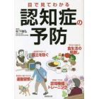 目で見てわかる認知症の予防