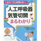 人工呼吸器・気管切開まるわかり　いざというとき困らない！　オールカラー