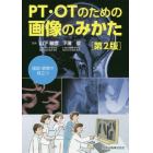 ＰＴ・ＯＴのための画像のみかた　国試・現場で役立つ