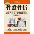 骨盤骨折　寛骨臼骨折・骨盤輪骨折の手術手技　写真・ＷＥＢ動画で理解が深まる